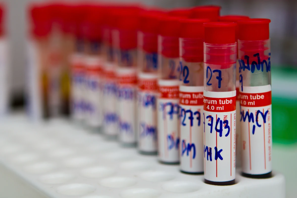 Laboratory blood sample tubes with red caps arranged in testing facility showing medical specimens for same day delivery